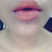腊肠窝
