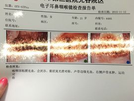 兔牙灬biubiu~主播照片
