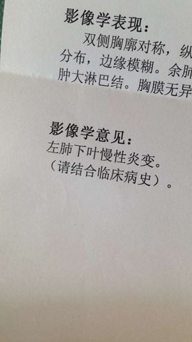 小鱼儿小白鲨主播照片