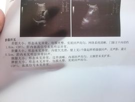 张大美_主播照片