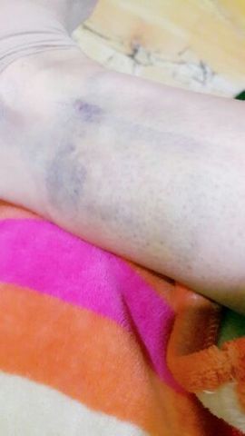 ♬默默✨小蛮宝☞🌜主播照片