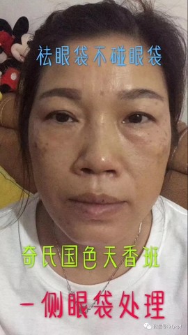 AD中推于明1355主播照片
