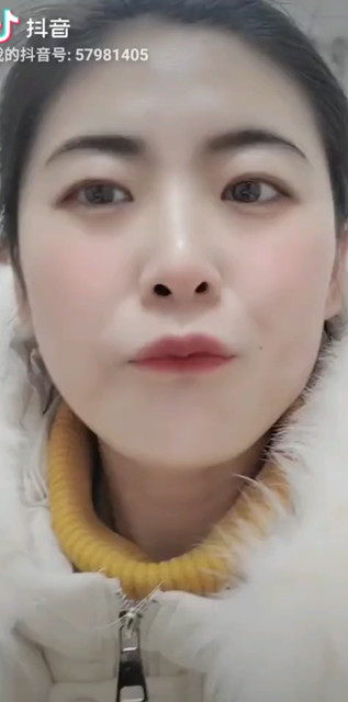 女神经