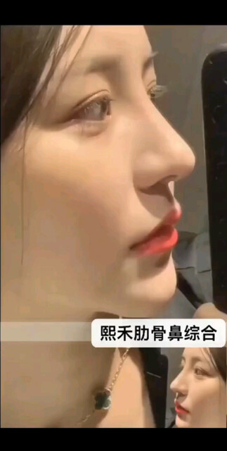 安好
