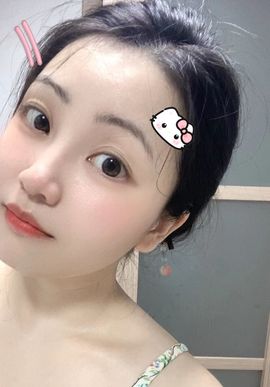 惊喜！！的图片