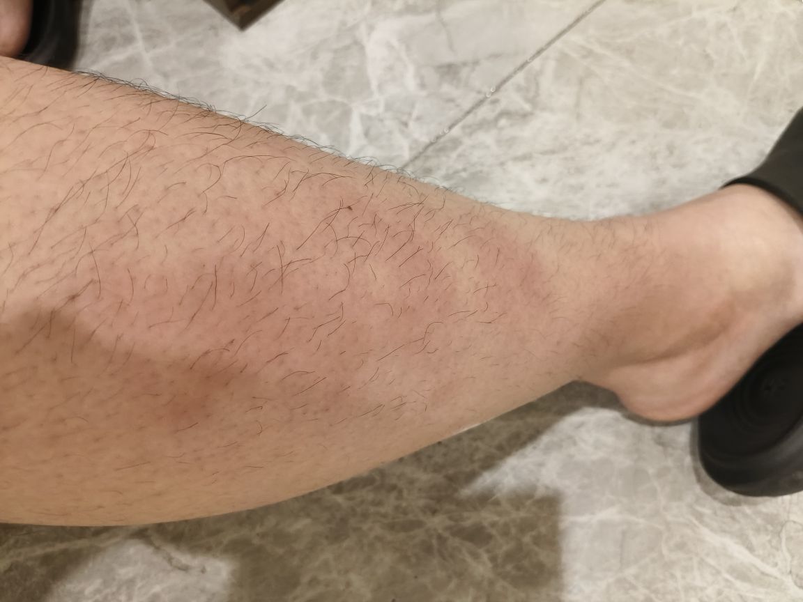 小林老弟腿伤休🤕的图片