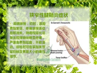 大拇指狭窄性腱鞘炎