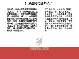 左手大拇指腱鞘炎