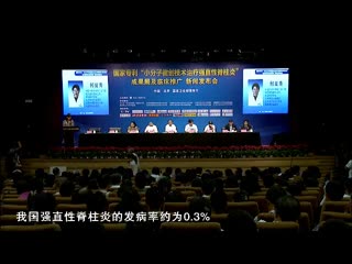 小分子微创技术治疗强直治愈率高吗