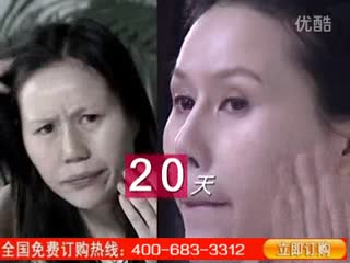 思兰朵祛斑 标清