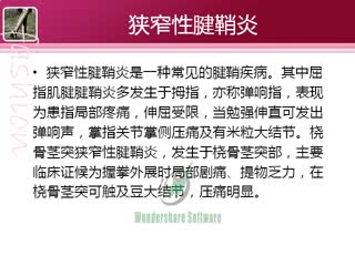 狭窄性腱鞘炎最佳治疗方法