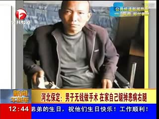没钱治病，保定硬汉自己锯断右腿